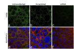 EEA1 Antibody in Immunocytochemistry (ICC/IF)