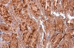 EEA1 Antibody in Immunohistochemistry (Paraffin) (IHC (P))