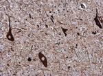 NF-H Antibody in Immunohistochemistry (Paraffin) (IHC (P))