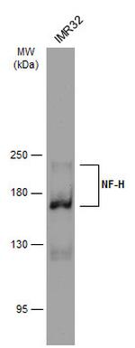 NF-H Antibody in Western Blot (WB)