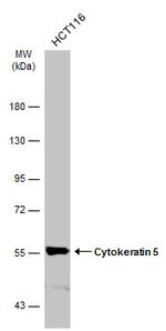 Cytokeratin 5 Antibody in Western Blot (WB)