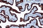 Cytokeratin 5 Antibody in Immunohistochemistry (Paraffin) (IHC (P))