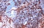 Cytokeratin 5 Antibody in Immunohistochemistry (Paraffin) (IHC (P))