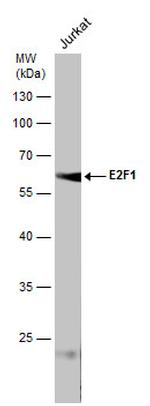 E2F1 Antibody in Western Blot (WB)