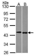 TRF1 Antibody in Western Blot (WB)