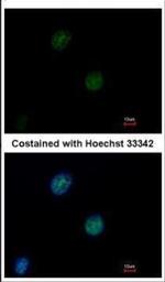 ATM Antibody in Immunocytochemistry (ICC/IF)