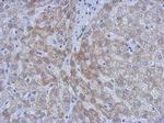 ATM Antibody in Immunohistochemistry (Paraffin) (IHC (P))