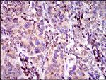 MRP4 Antibody in Immunohistochemistry (Paraffin) (IHC (P))