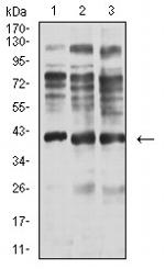 Centaurin alpha-1 Antibody in Western Blot (WB)