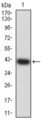 Centaurin alpha-1 Antibody in Western Blot (WB)