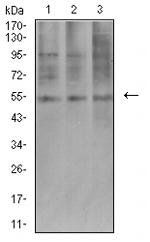 AEBP2 Antibody in Western Blot (WB)