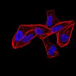 ALDH6A1 Antibody in Immunocytochemistry (ICC/IF)