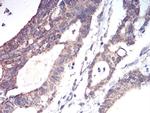 ALDH6A1 Antibody in Immunohistochemistry (Paraffin) (IHC (P))