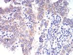 ALDH6A1 Antibody in Immunohistochemistry (Paraffin) (IHC (P))