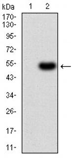 ALDH6A1 Antibody in Western Blot (WB)