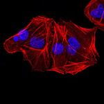 ALDH6A1 Antibody in Immunocytochemistry (ICC/IF)