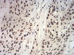 APC10 Antibody in Immunohistochemistry (Paraffin) (IHC (P))