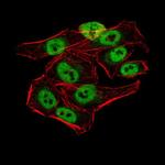 KDM1B Antibody in Immunocytochemistry (ICC/IF)