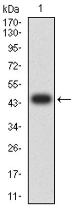 ATRX Antibody in Western Blot (WB)