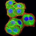 BCL11B Antibody in Immunocytochemistry (ICC/IF)