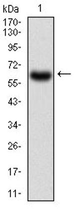 CaMKII gamma Antibody in Western Blot (WB)