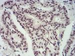 CBX4 Antibody in Immunohistochemistry (Paraffin) (IHC (P))