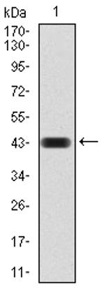 CBX4 Antibody in Western Blot (WB)