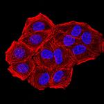 CBX7 Antibody in Immunocytochemistry (ICC/IF)