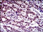 FLIP Antibody in Immunohistochemistry (Paraffin) (IHC (P))