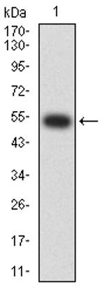 CHRNA2 Antibody in Western Blot (WB)