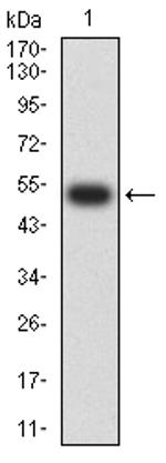 CHRNA4 Antibody in Western Blot (WB)