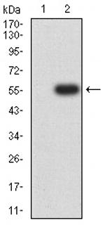 CHRNA4 Antibody in Western Blot (WB)