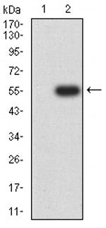 CHRNA6 Antibody in Western Blot (WB)