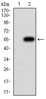 CHRNB4 Antibody in Western Blot (WB)