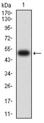 CHRNB4 Antibody in Western Blot (WB)