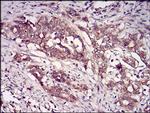 CK2 beta Antibody in Immunohistochemistry (Paraffin) (IHC (P))