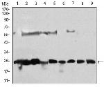 CK2 beta Antibody in Western Blot (WB)