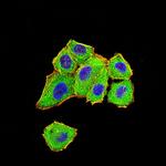 DDX1 Antibody in Immunocytochemistry (ICC/IF)