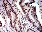 DDX1 Antibody in Immunohistochemistry (Paraffin) (IHC (P))