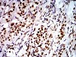 DDX1 Antibody in Immunohistochemistry (Paraffin) (IHC (P))