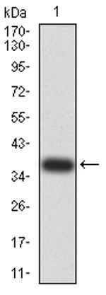 DDX1 Antibody in Western Blot (WB)