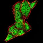 Gemin 3 Antibody in Immunocytochemistry (ICC/IF)