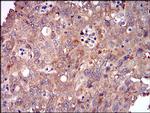 DIS3L2 Antibody in Immunohistochemistry (Paraffin) (IHC (P))