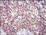 DIS3L2 Antibody in Immunohistochemistry (Paraffin) (IHC (P))