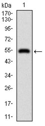 DIS3L2 Antibody in Western Blot (WB)