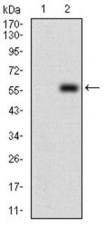 DIS3L2 Antibody in Western Blot (WB)