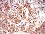 EIF2A Antibody in Immunohistochemistry (Paraffin) (IHC (P))