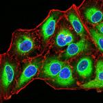 Emerin Antibody in Immunocytochemistry (ICC/IF)