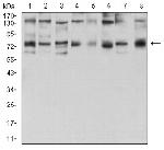 GFPT1 Antibody in Western Blot (WB)