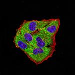 GLRB Antibody in Immunocytochemistry (ICC/IF)